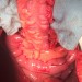 esophagus-color-200x150